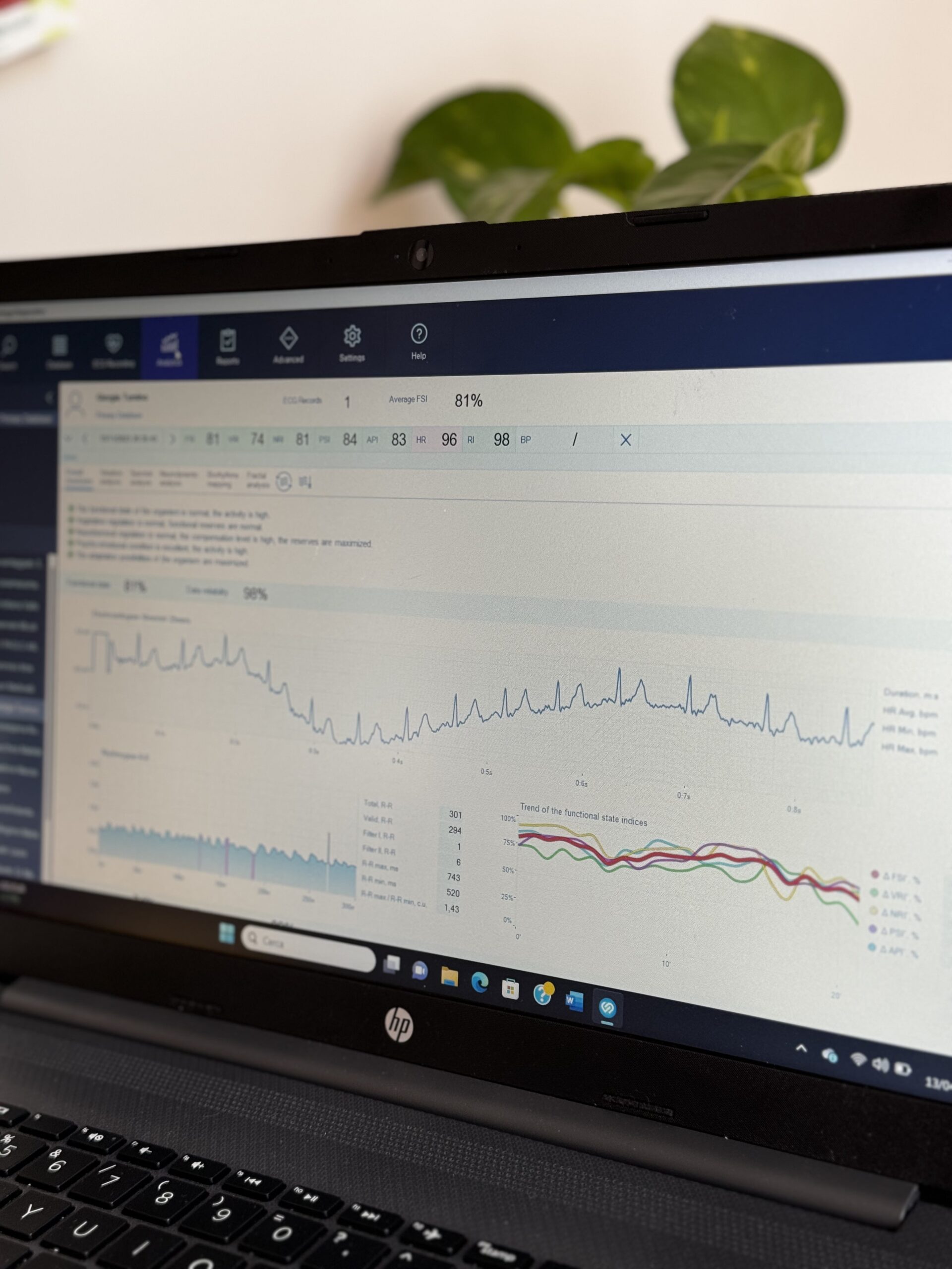 Grafici di analisi del test di valutazione dello stress per il monitoraggio e la pianificazione del benessere.
